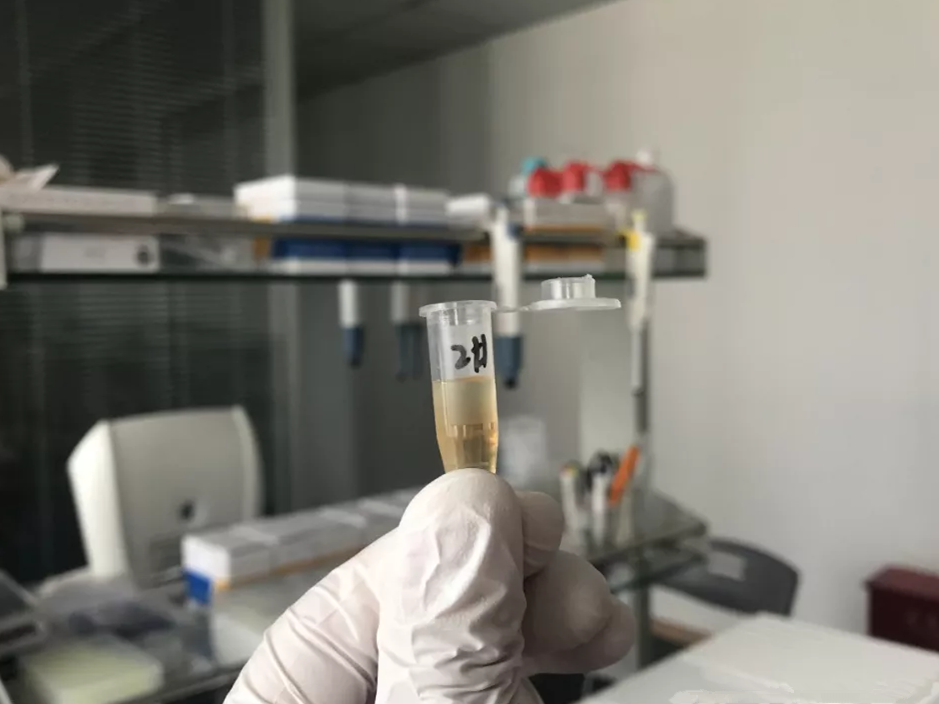 水煮花生含甲醛？實測多家燒烤店結果太可怕！