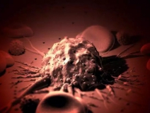 癌癥、白血病越來越多,是因為時代在進步而導致的嗎?