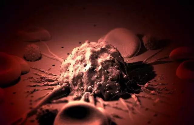 癌癥、白血病越來越多，是因為時代在進步而導(dǎo)致的嗎？